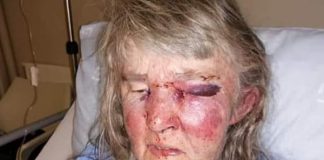 Touwsrivier attack, elderly woman violently assaulted. Photo: BKA Boere Krisis Aksie