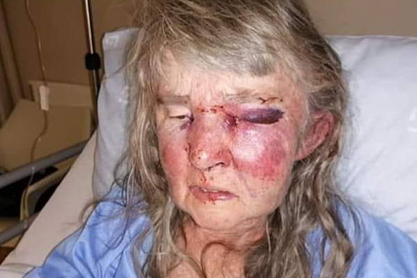 Touwsrivier attack, elderly woman violently assaulted