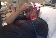 Man hospitalized after violent assault. Photo: oorgrens Veiligheid