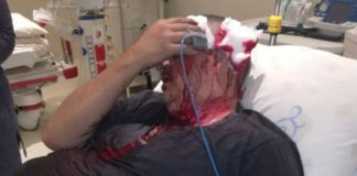 Man hospitalized after violent assault. Photo: oorgrens Veiligheid