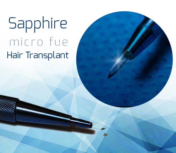 Hair transplant. What is the Sapphire FUE method?