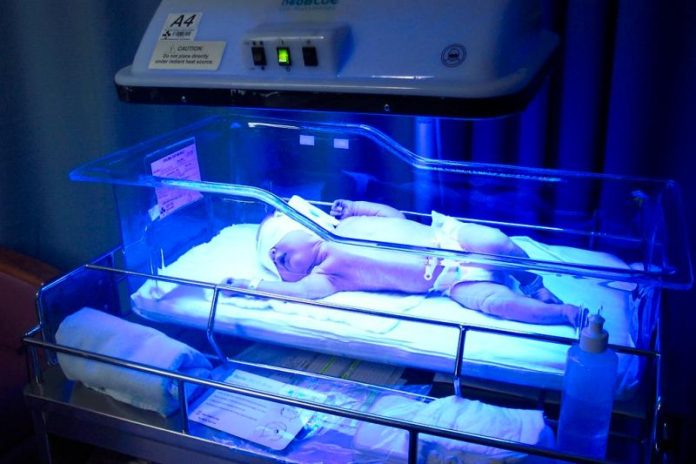 Infant Phototherapy Device Market is Booming Worldwide 2021-2030 Infant Phototherapy Device Market is Booming Worldwide 2021-2030