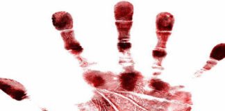 Farm attack, man hospitalised after panga attack, White River