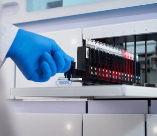 Roche launches cobas® 5800, a new molecular diagnostics system to expand access to testing and improve patient care