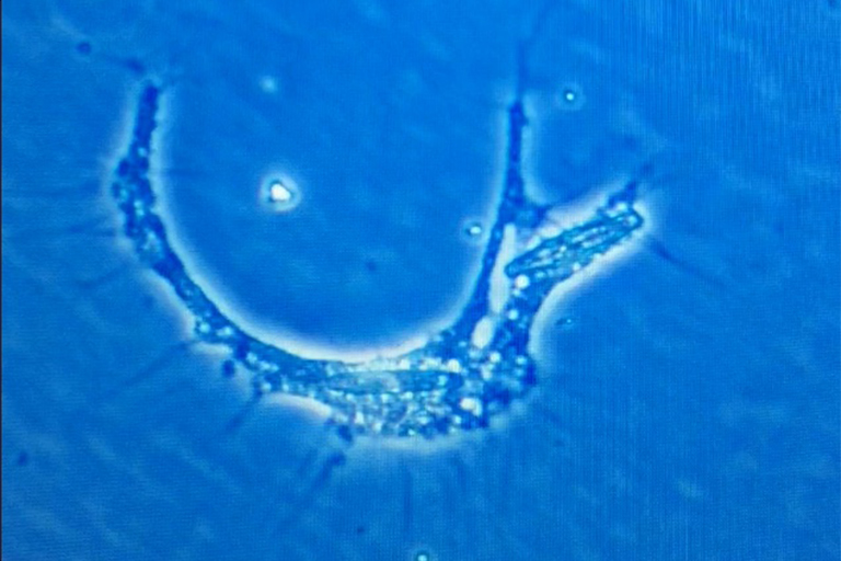 A marine amoeba ingests two diatoms.