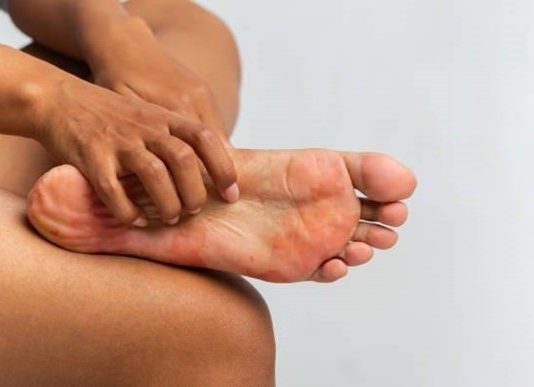 The best tips and tricks for preventing and treating corns and calluses