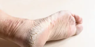 Kroko shares 5 ageing footcare tips to keep feet healthy in later years Kroko shares 5 ageing footcare tips to keep feet healthy in later years