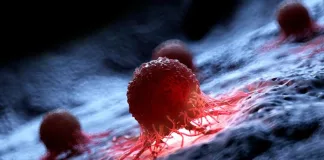 BLOOD CANCER: EARLY SYMPTOMS AND WARNING SIGNS BLOOD CANCER: EARLY SYMPTOMS AND WARNING SIGNS