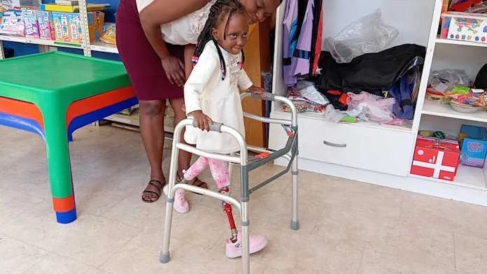 3-year-old-Minenhle-Ndlovu 3 year old Minenhle Ndlovu now has her new prosthetics giving her a fresh start in life