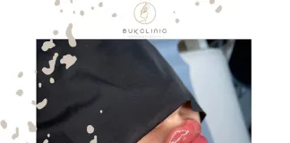 Top 10 Clinics for Dermal Fillers in Istanbul, Turkey Top 10 Clinics for Dermal Fillers in Istanbul, Turkey