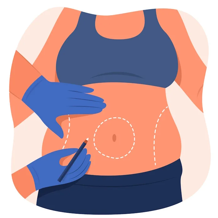 23991689_6877738 Cosmedica Aesthetic Offers World-Class Liposuction in Turkey for Global Beauty Seekers