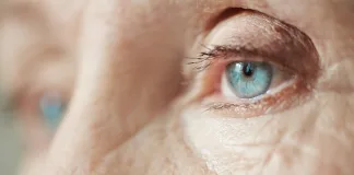 RISING DIABETES INCREASING CATARACTS, THE LEADING CAUSE OF PREVENTABLE BLINDNESS
