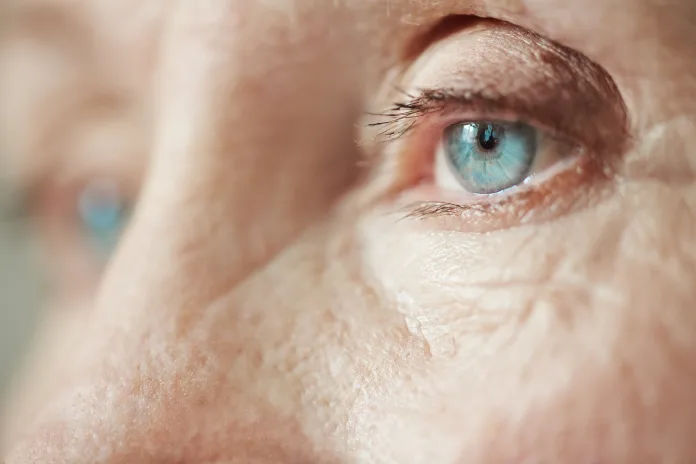 Eyecare-Awareness-Week RISING DIABETES INCREASING CATARACTS, THE LEADING CAUSE OF PREVENTABLE BLINDNESS