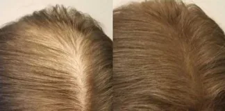 How To Get Thick Hair Naturally: Which Ingredients & Spray Products Work Best How To Get Thick Hair Naturally: Which Ingredients & Spray Products Work Best