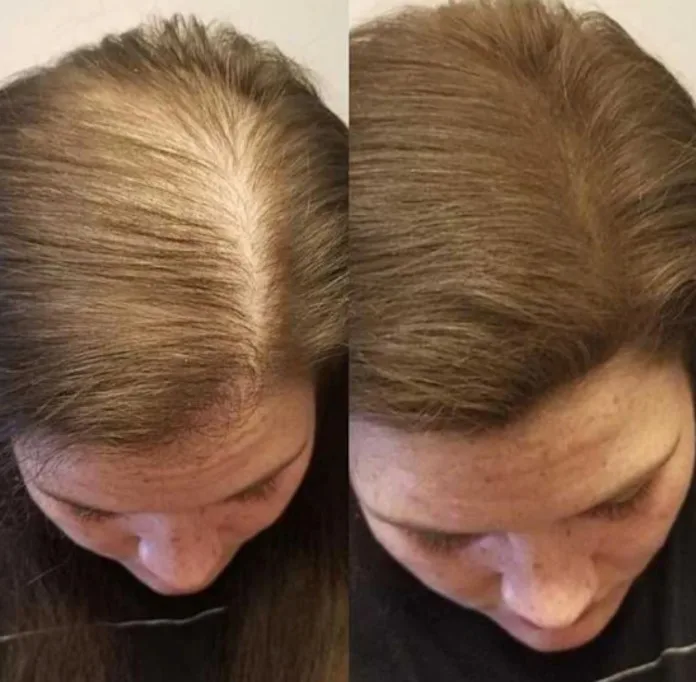 Thick-Hair-Naturally-Which-Ingredients-20250904 How To Get Thick Hair Naturally: Which Ingredients & Spray Products Work Best