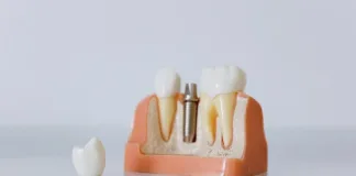 A review of cutting-edge innovations in dental implantology A review of cutting-edge innovations in dental implantology