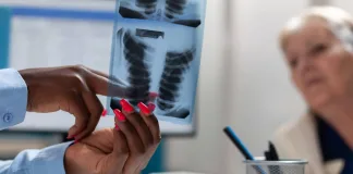 Can TB Return? Understanding TB Relapse and Reinfection
