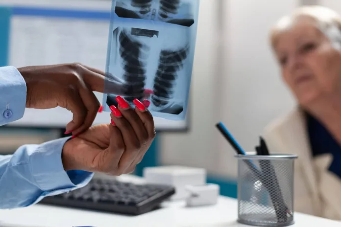 Can TB Return? Understanding TB Relapse and Reinfection