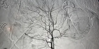 Beyond diagnosis: The treatment power of modern radiology