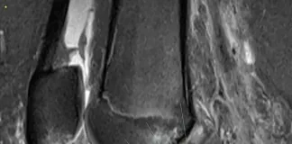 Understanding sports injuries: The role of radiology in diagnosis and recovery Understanding sports injuries: The role of radiology in diagnosis and recovery