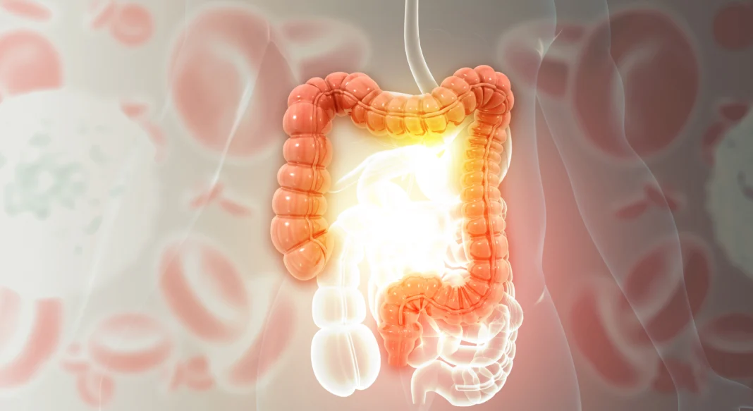 Looking Beyond Symptoms to Improve Long-Term IBD Care. Image supplied by PR company.