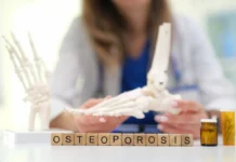 Osteoporosis Warning Signs and Risk Factors Osteoporosis Warning Signs and Risk Factors. Image supplied by PR company.